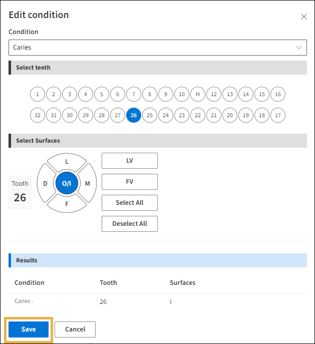 Edit Condition window with a yellow highlight around Save.